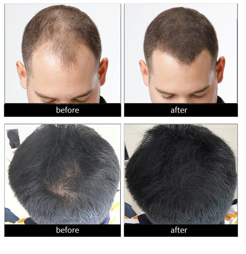 Thick Fiber Hair Building Fiber Spray Hair Fiber Buy Hair