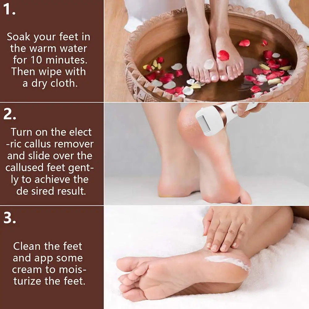 foot callous remover (7).jpg