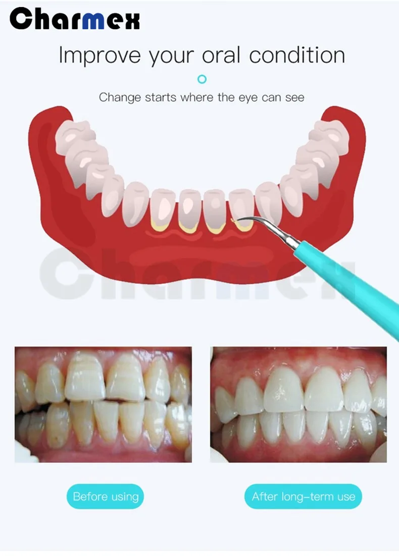 dental air scaler