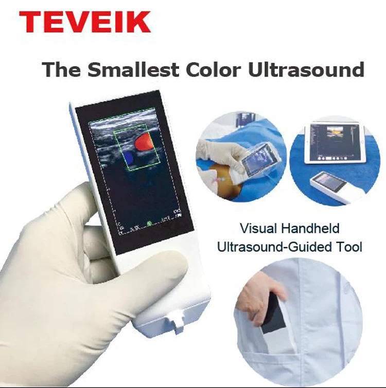 2020 New Mini Android Colorful Wireless Ultrasound Scanner Doppler Probe Ultrasound Wifi