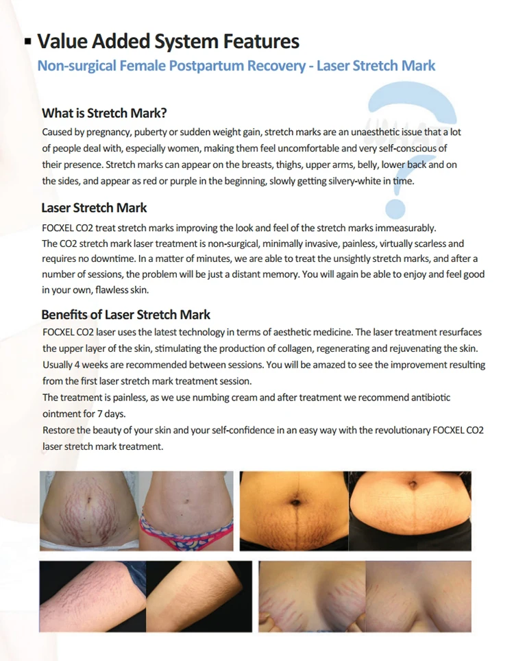 Vaginal Tightening Laser CO2 Fractional Laser For Cosmetology acnescarremoval fractional co2 laser skin resurfacing machine