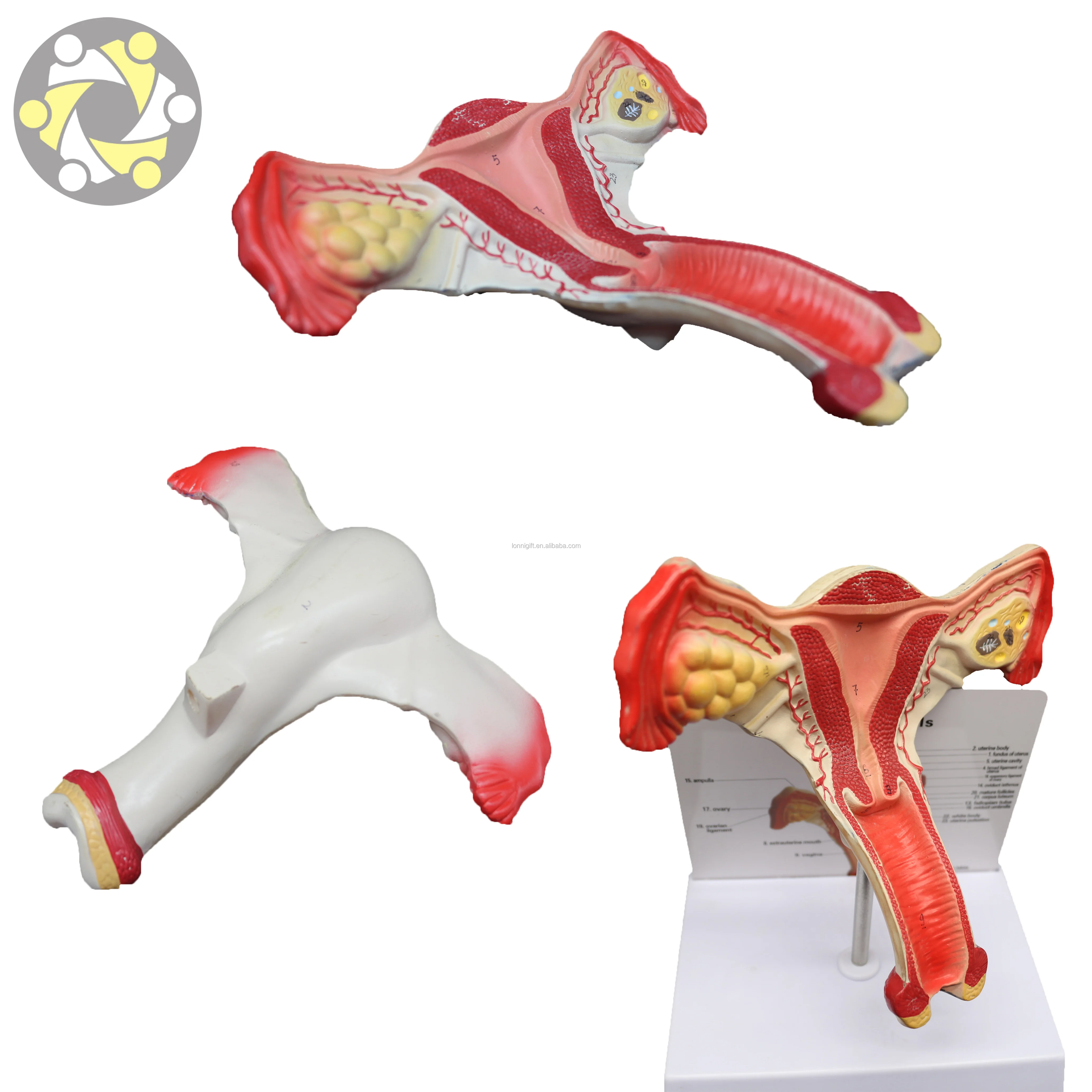 Female Reproduction Model Pathological Anatomical Of Uterus Teaching 2689