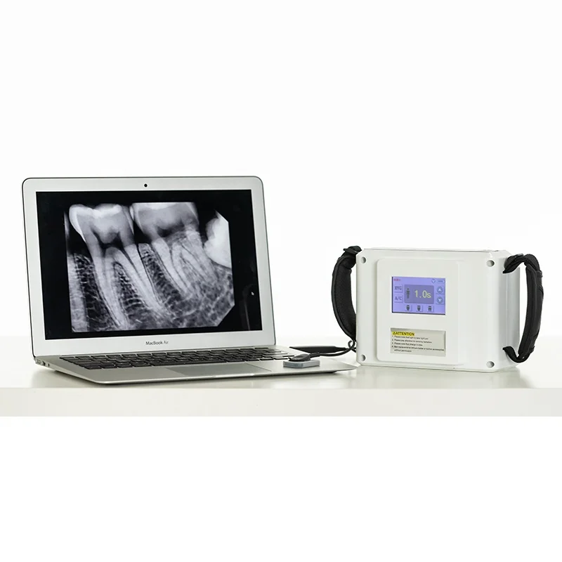 便携式牙科全景传感器x光机牙科x射线摄影设备机器