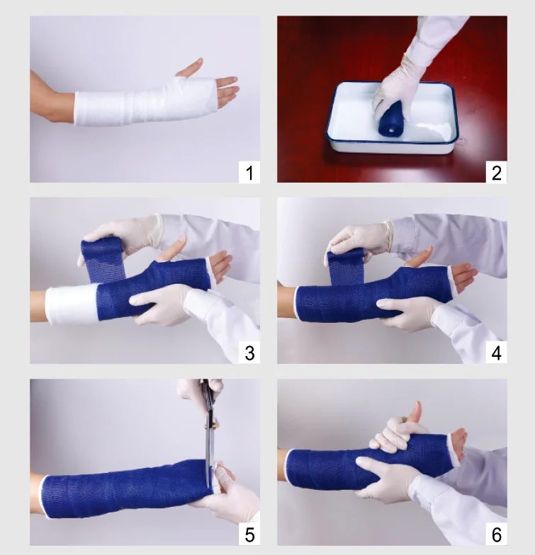 CE Approved Breathable Medical Polyester Fiberglass Surgical