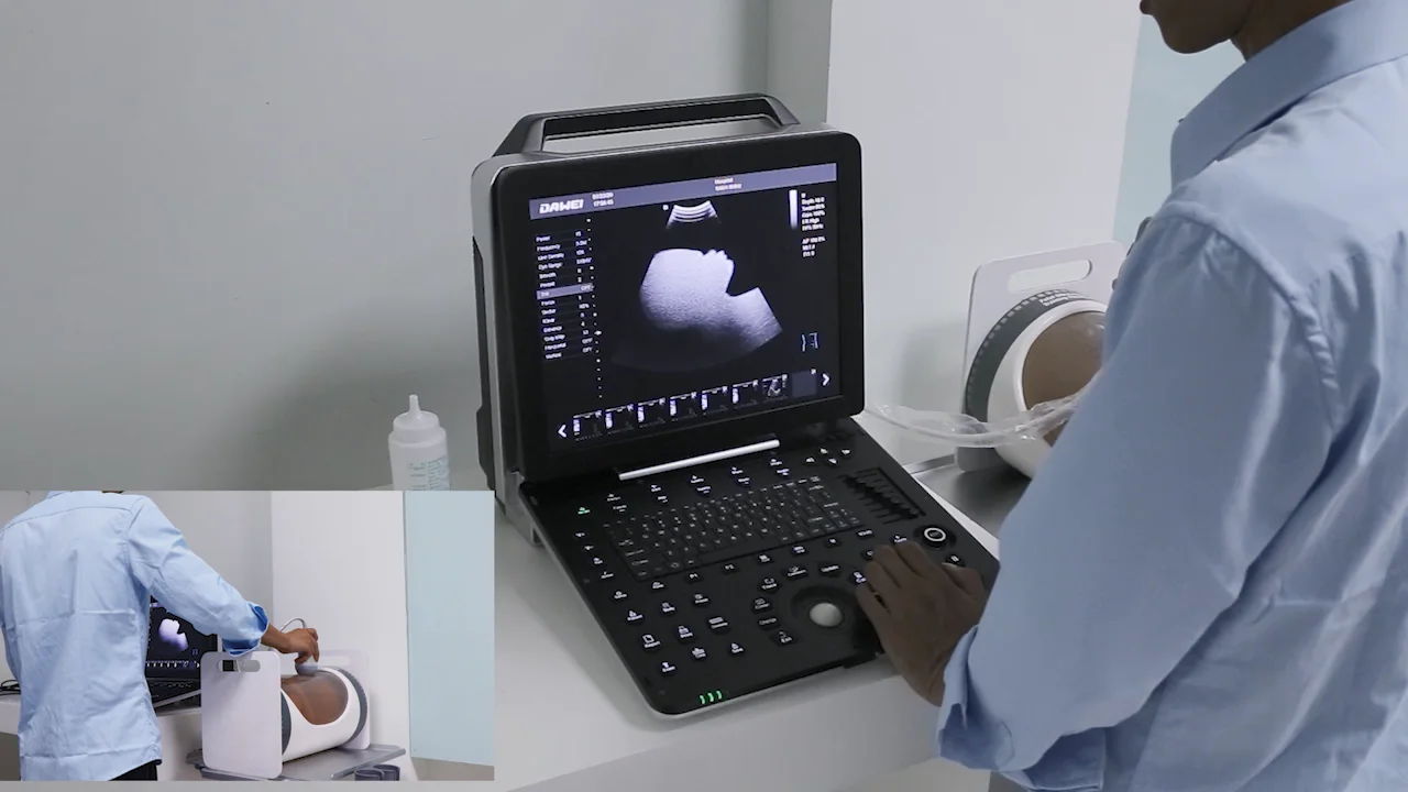 DW3101A Cheap 2D Portable Echo Ultrasonic Ultrasound Machine, View
