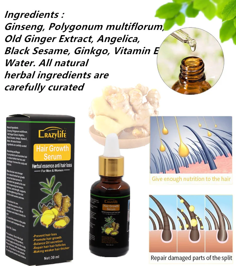 Ginger Essence Hair Dressing Growth Essence Liquid Fast Growth Natural ...