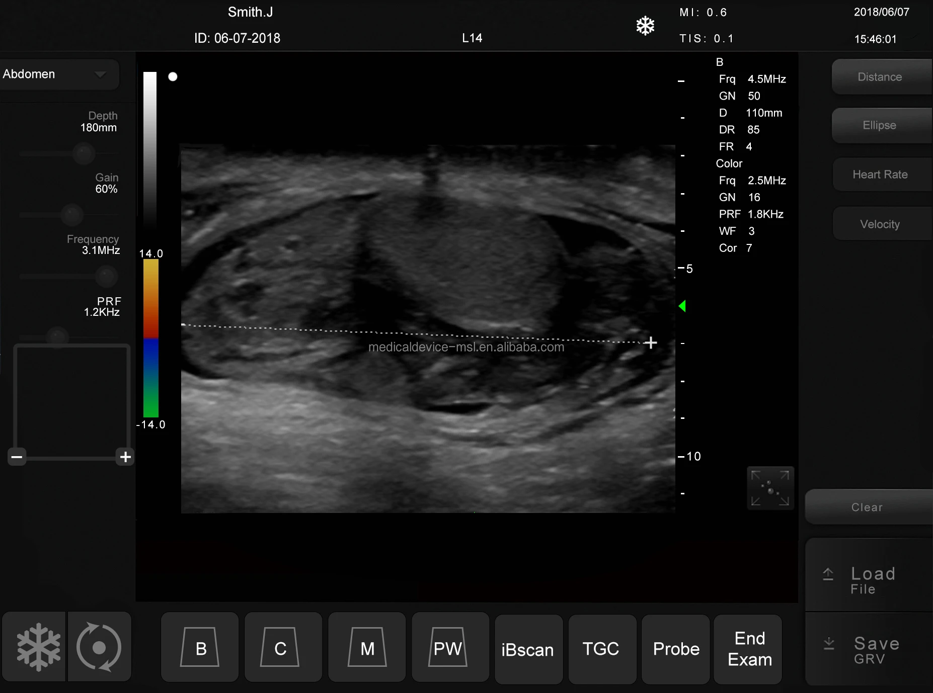 cow-colour-doppler.jpg