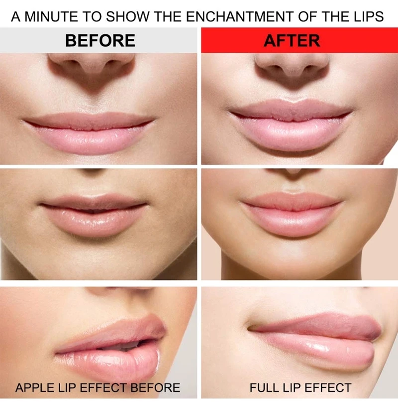 marriage resist fell Electric Collagen Automatic Enhancer Private Label Gloss Device Bigger  Thicker Lips For Women Automatic Lip Plumper - Buy Thicker Suction Tool,Lip  Plumper Enhancer,Lip Plumper Enhancer Tool Product on Alibaba.com