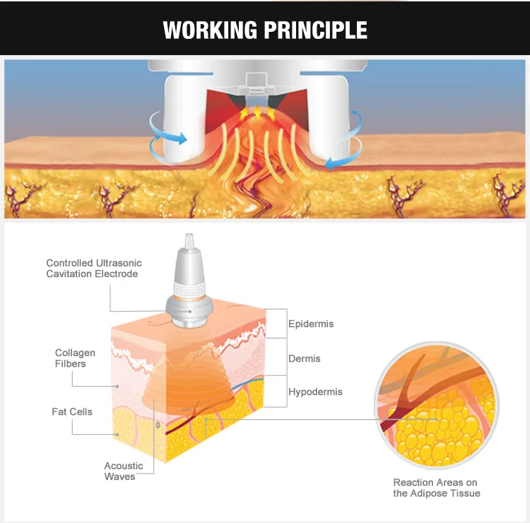 cavitation theory.jpg