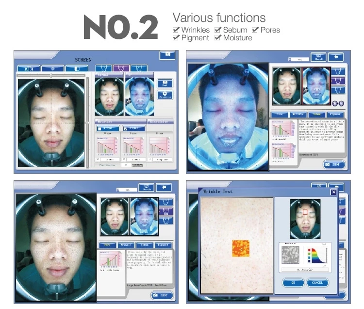 3d facial skin analyzer/face visia skin analysis machine