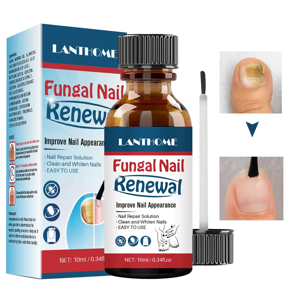 Lanthome 10ml Nail Repair Solution Clean Whiten Nourish Nails Fungal