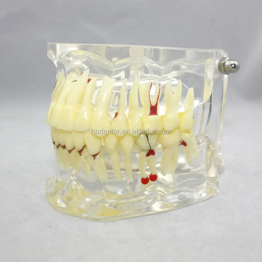 teeth model.JPG