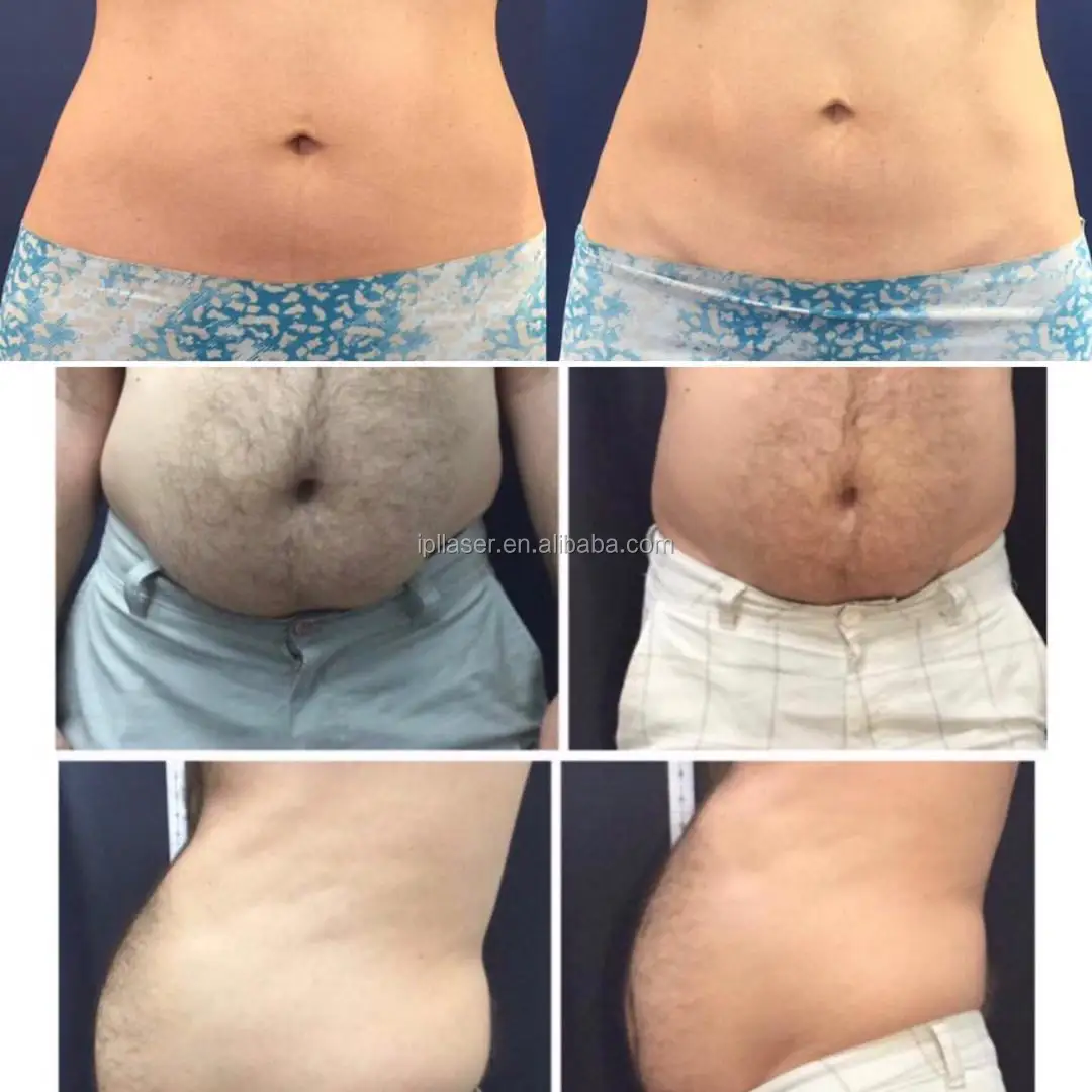 before and after (1).jpg