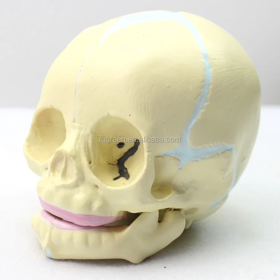 Недооформленный череп у ребенка