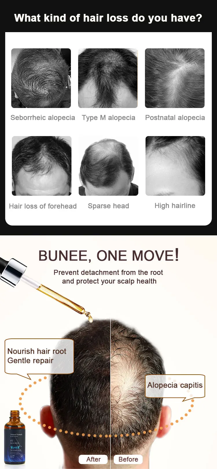 Bunee 60ml Treatment Of Hair Loss Tonic Hair Growth Serum Buy Hair Serum Hair Tonic Hair Growth Serum Product On Alibaba Com