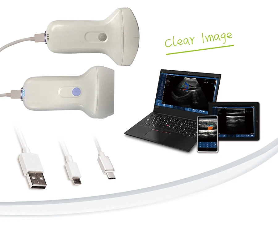 L'antenne réseaux rectilignes tenue dans la main visuelle d'imagerie numérique d'USB et de WIFI colorent l'ultrason probe.jpg