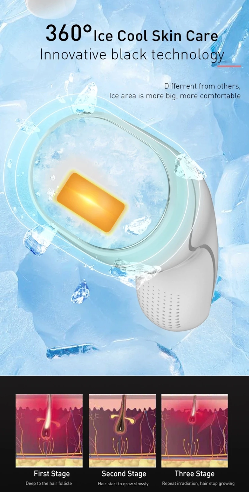 Handheld Ice Cooling Ipl Laser Hair Removal Handset Buy Ipl Laser