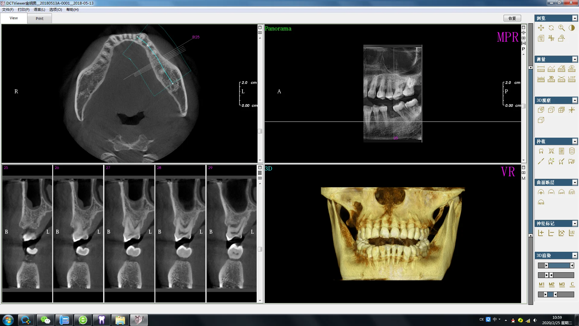 Dental Instruments Mouth Unit Digital Cbct 3d Opg X Ray Ct Scanner ...