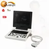 High technology laptop abdomen Ultrasound device scanner with high quality