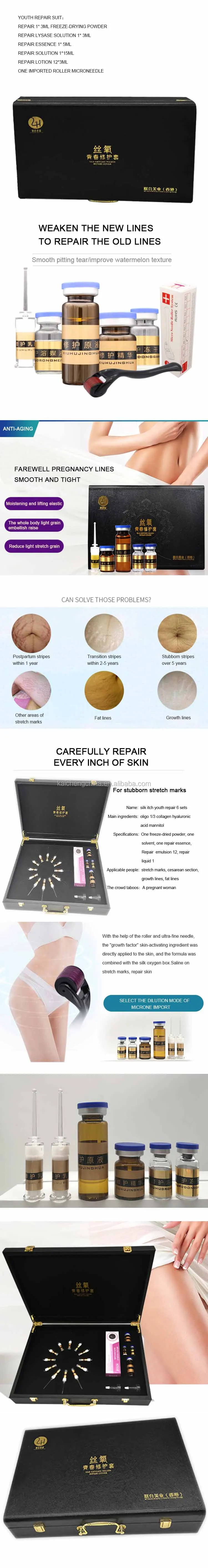 cellulite and stretch mark removal