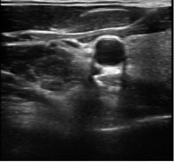 paste-pic-dp_uuid_o0dhb