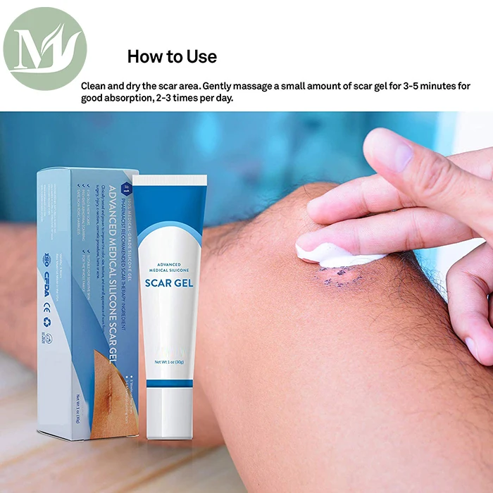medical grade stretch mark cream
