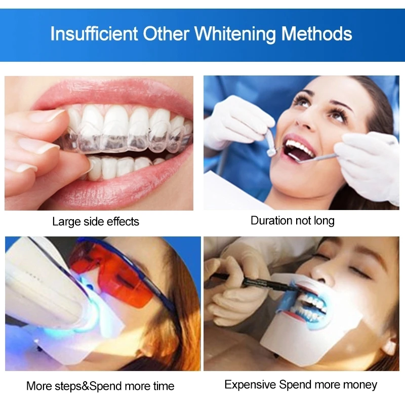 14pcs/7pair 3d White Gel Teeth Whitening Strips Tooth ...