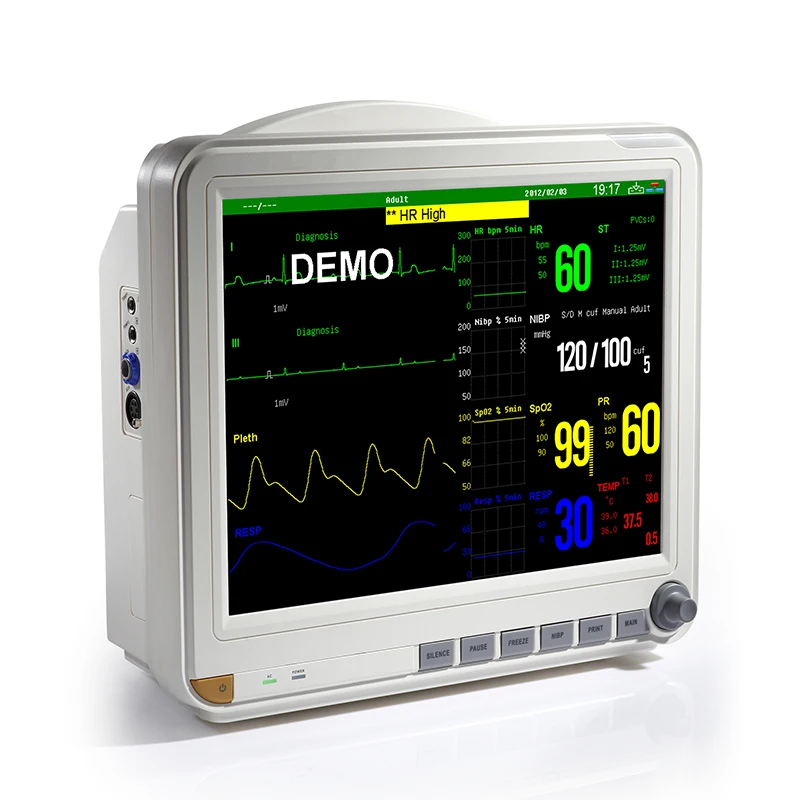 Monitor (2).jpg