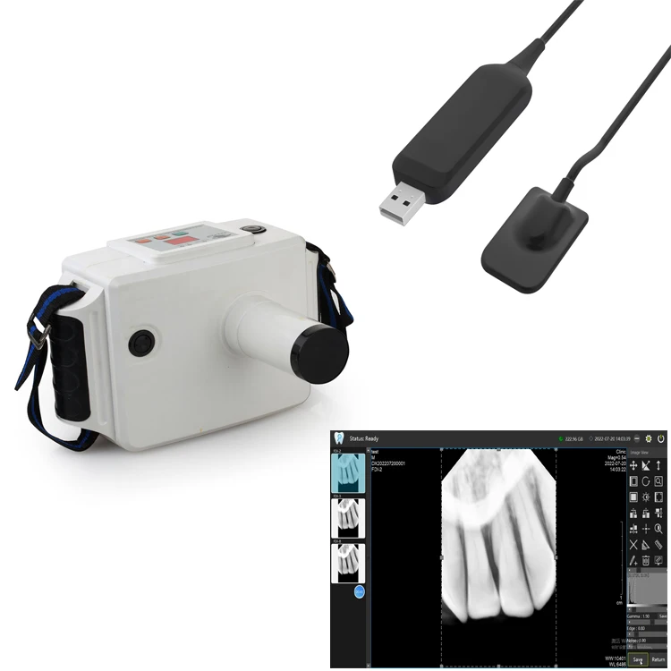 Iray Dental X Ray Rvg Sensor Dental Xray Machine For Human Or Vet Use