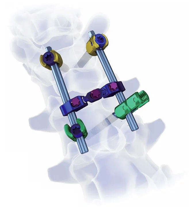 Spinal Pedicle Screw And Rod Fixation System For Titanium Orthopedic