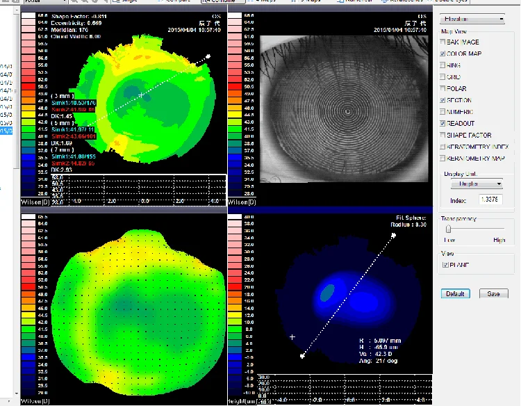 SW-6000 Cheap Price Ophthalmic Topographer Equipment China Corneal Topography