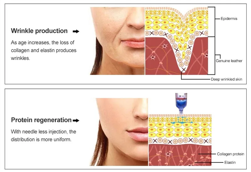 Working principle.jpg