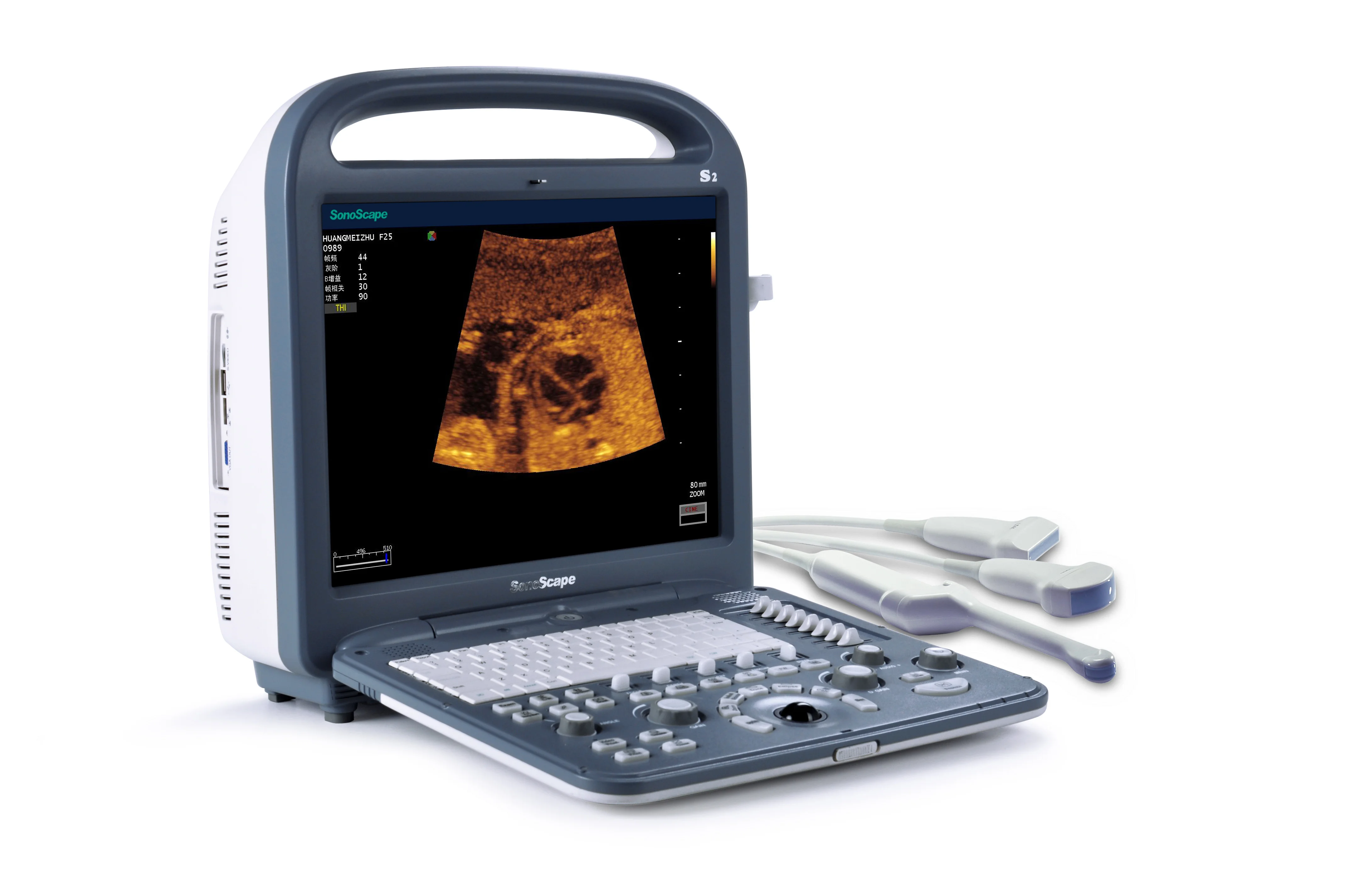 newest sonoscape e2 portable ultrasound machine