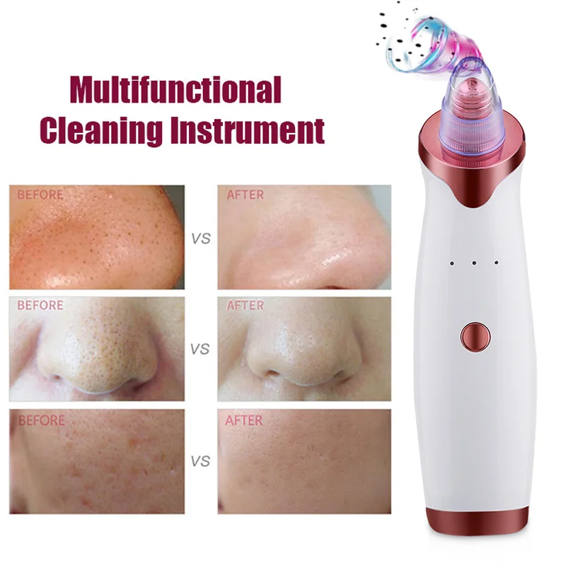 2020 Best Selling 5 In 1 Facial Pore Deep Cleaning Electric Blackhead Remover Vacuum Pore Vacuum Cleaner