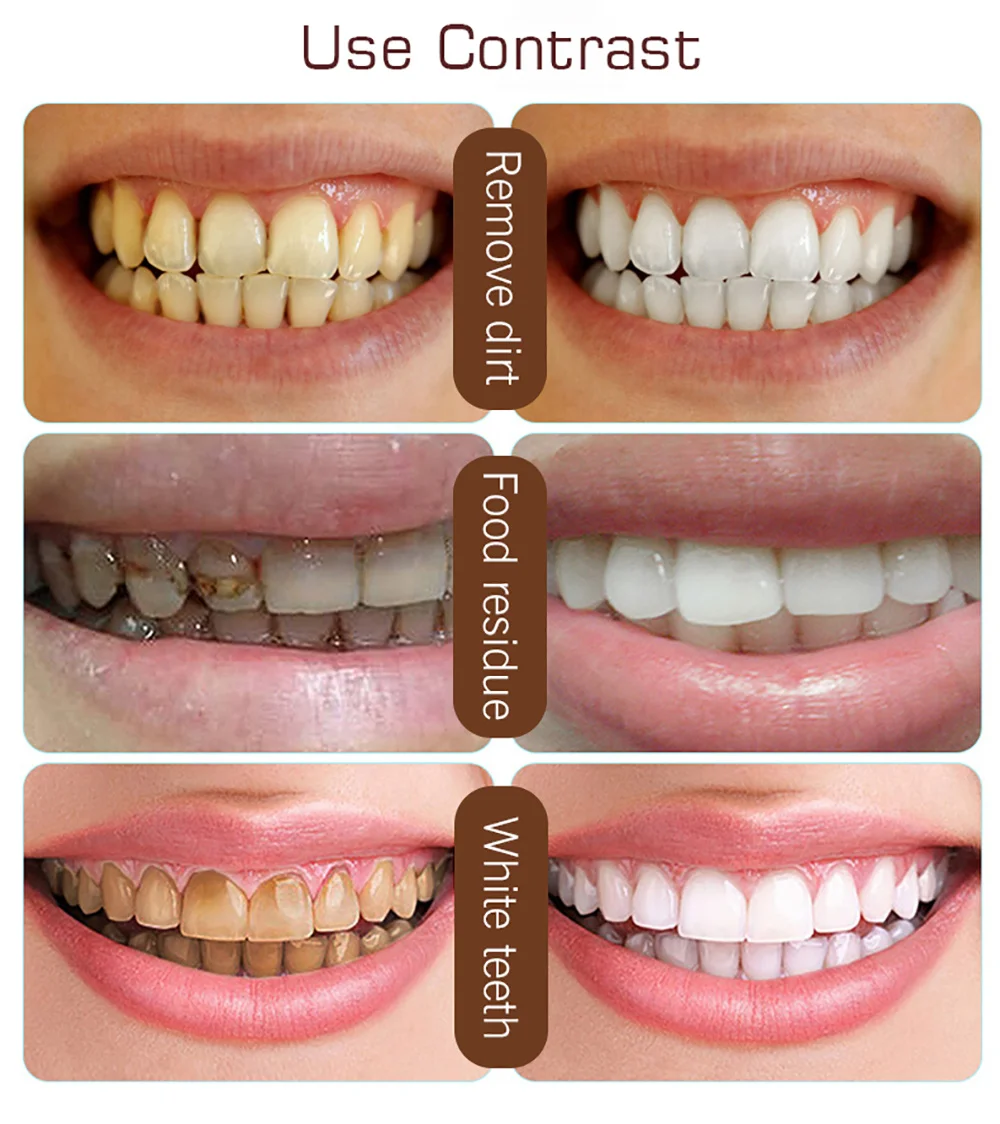 Отбеливание зубов активированным. Отбеливание зубов углем до и после. Отбелить зубы активированным углем. Отбелить зубы углем до после. Активированный уголь для отбеливания зубов.