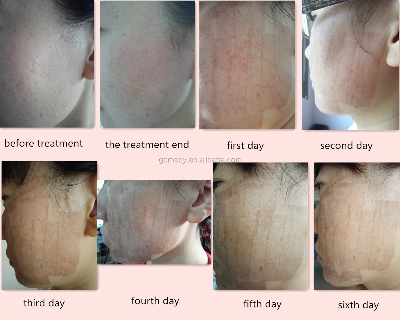 treatment before and after.jpg
