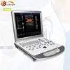 128 elements color doppler portable ultrasound machines/3d color doppler ultrasound system