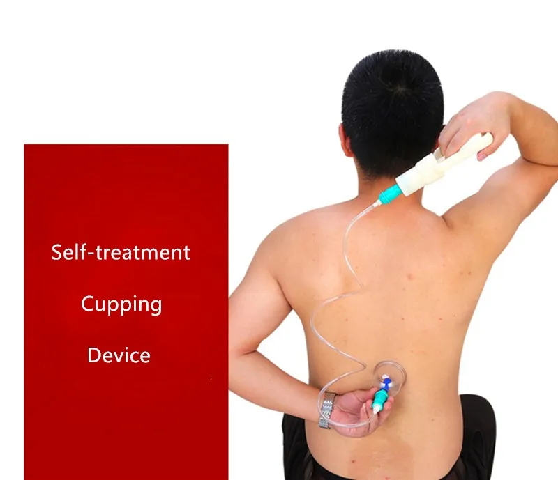 personal cupping.jpg