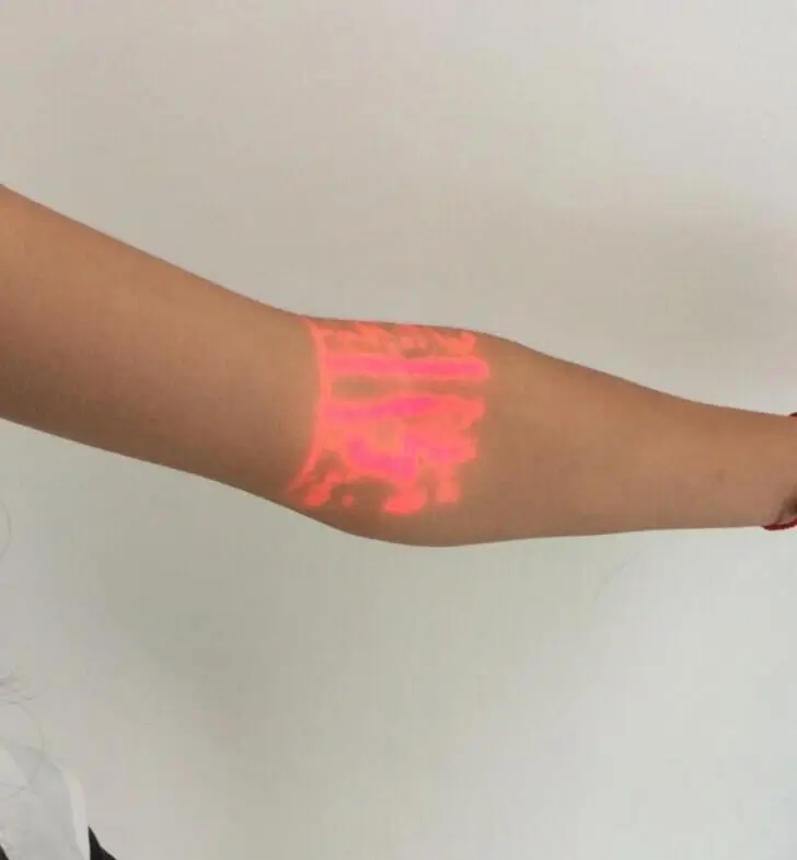 Arm.jpg