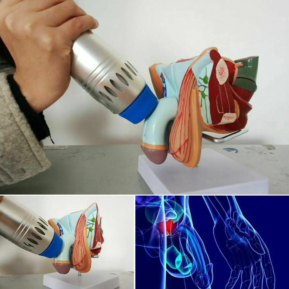 2019 hot new products zimmer shockwave /equine shock wave therapy machine