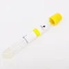 Ce Prp Supplies Triple Sterile Best Price Platelet Rich Plasma Acd Gel Easy Use Prp Tube For Doctor