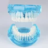Dental Tooth Orthodontic Model Half Metal Brackets & Half Ceramic Brackets/Demonstration Orthodontic Model M3003