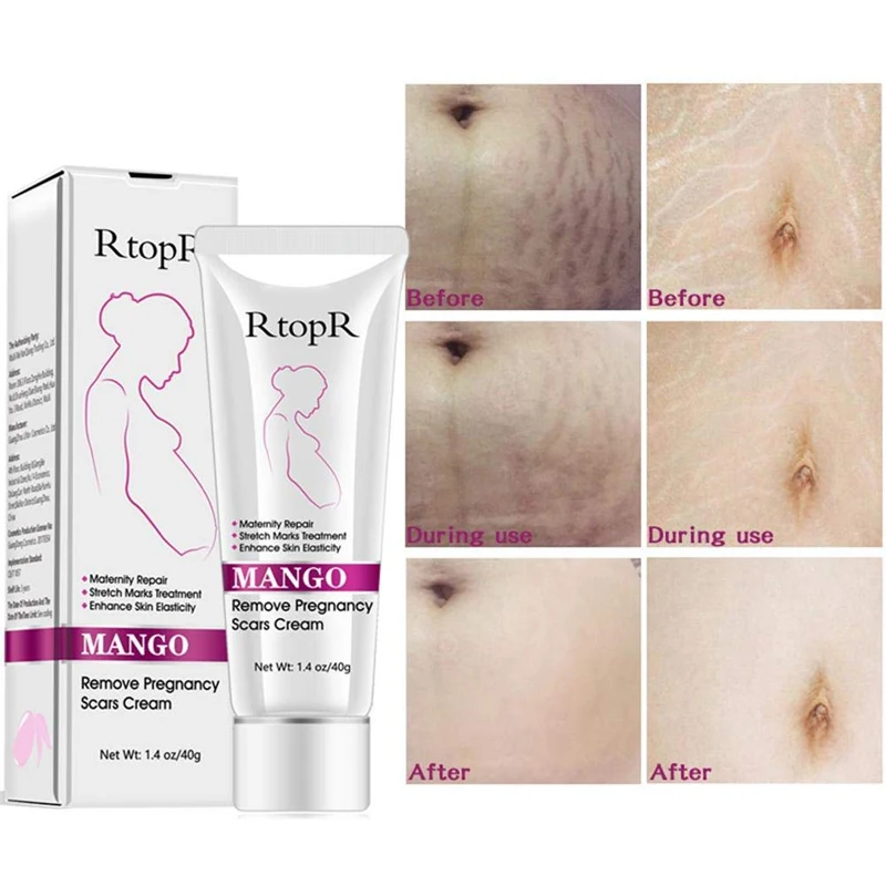 stretch marks cream (6).jpg