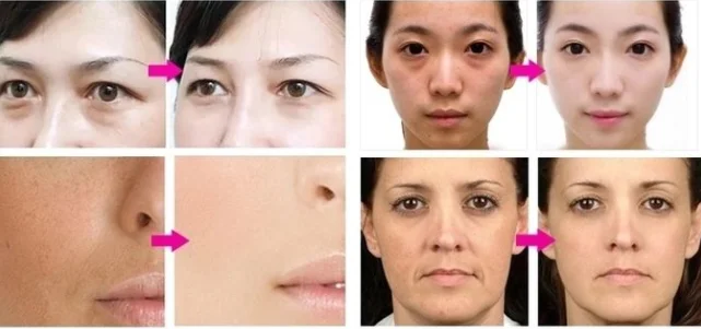 paste-pic-dp_uuid_di78x