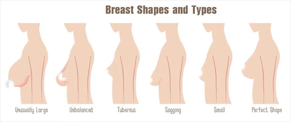 oem otesaly 玻尿酸注射丰胸和大屁股