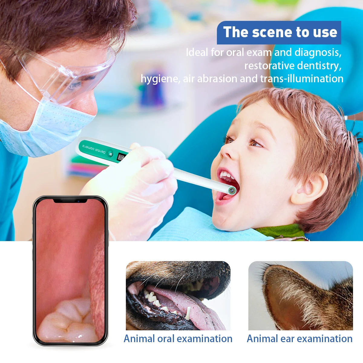 intraoral camera