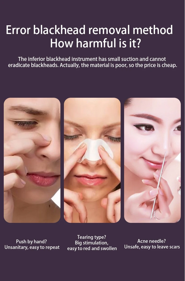 blackhead removal 3