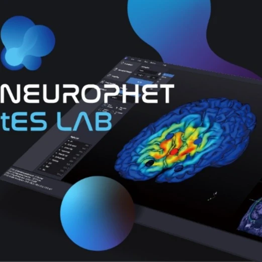 
NEUROPHET tES LAB can makes fully automated brain segmentation 