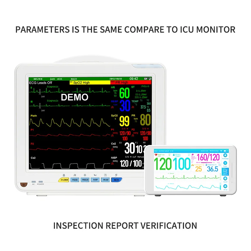 product nibp spo2 breathing monitor handheld small cheap holter wireless ecg recorder portable ecg device electric plastic ce class ii-66