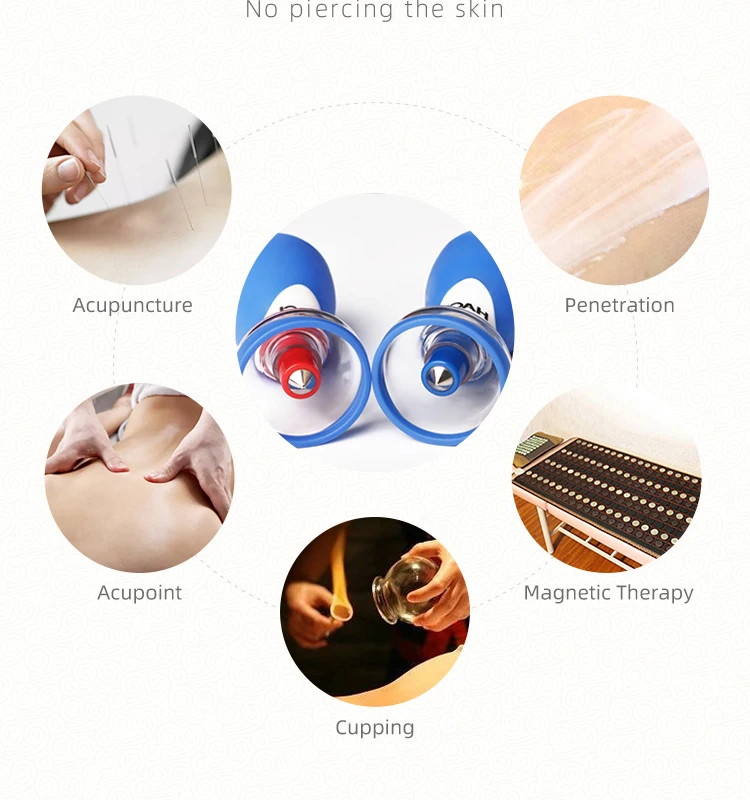 Chinese Cupping Therapy Upgrade Haci Fivestar Needle Therapy Cupping 10 Cups Buy